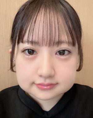 相川暖花の抜歯後の写真